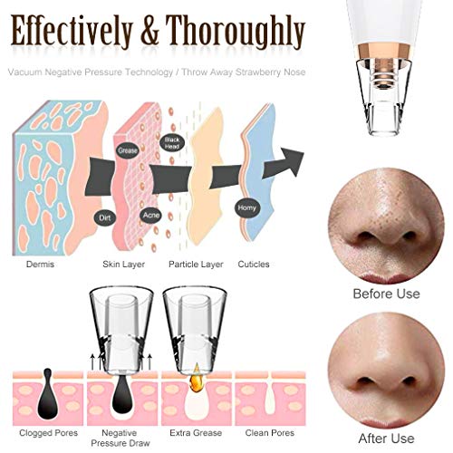 Blemish and Blackhead Removal Tool