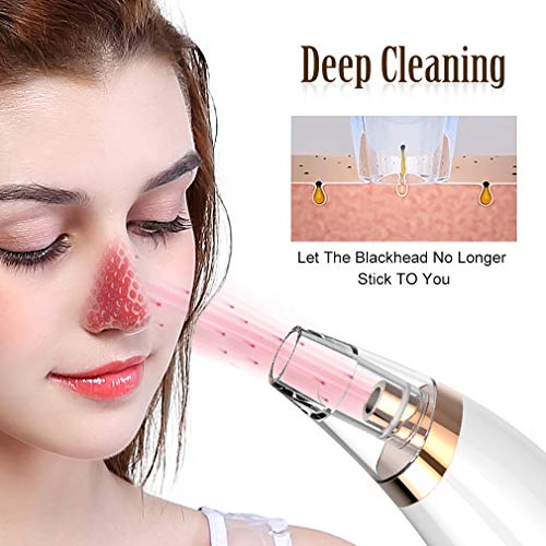 Blemish and Blackhead Removal Tool